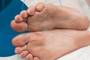 symptoms-of-diabetes.jpg
