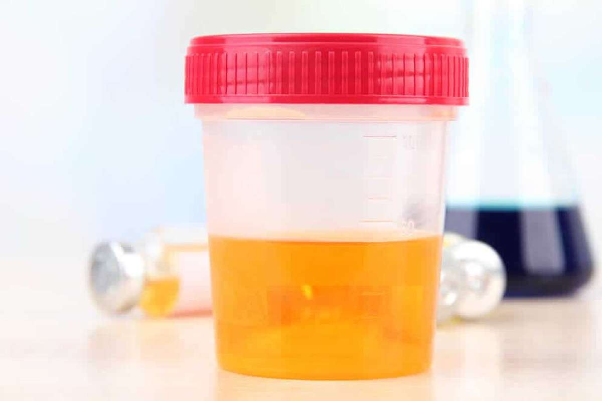 orange-urine.jpg