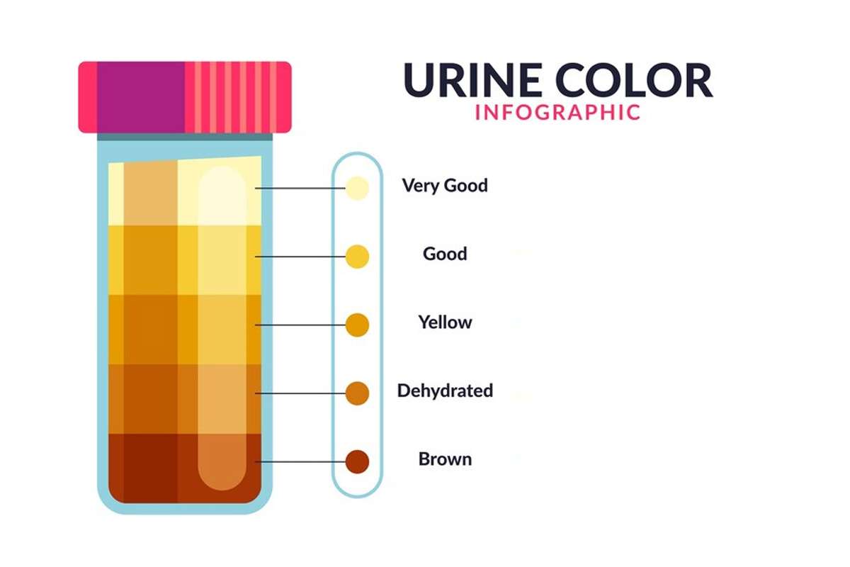 urine-colour-chart.jpg