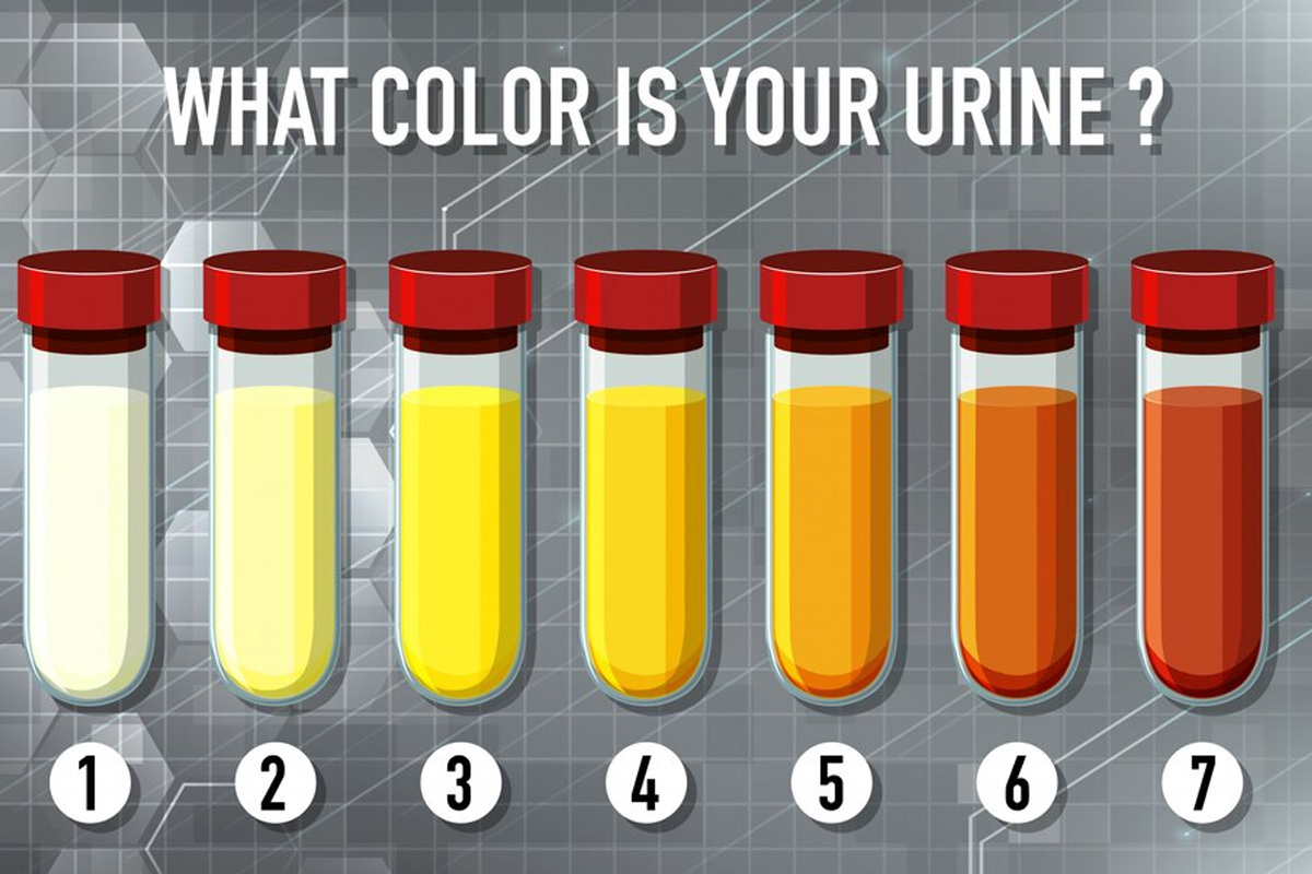 पेशाब का रंग पहले ही बता देता है बीमारियों का संकेत, अगर ऐसा है रंग तो तुरंत
जाएं डॉक्टर के पास
