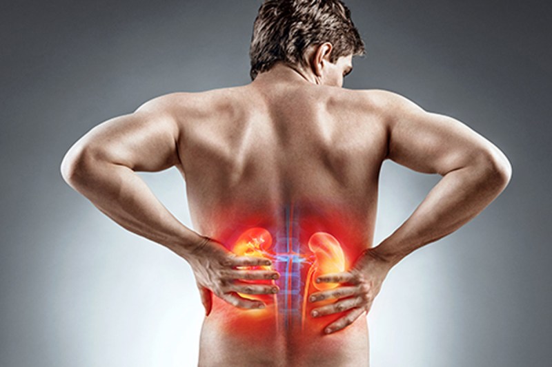 symptoms-of-kidney-stones.jpg