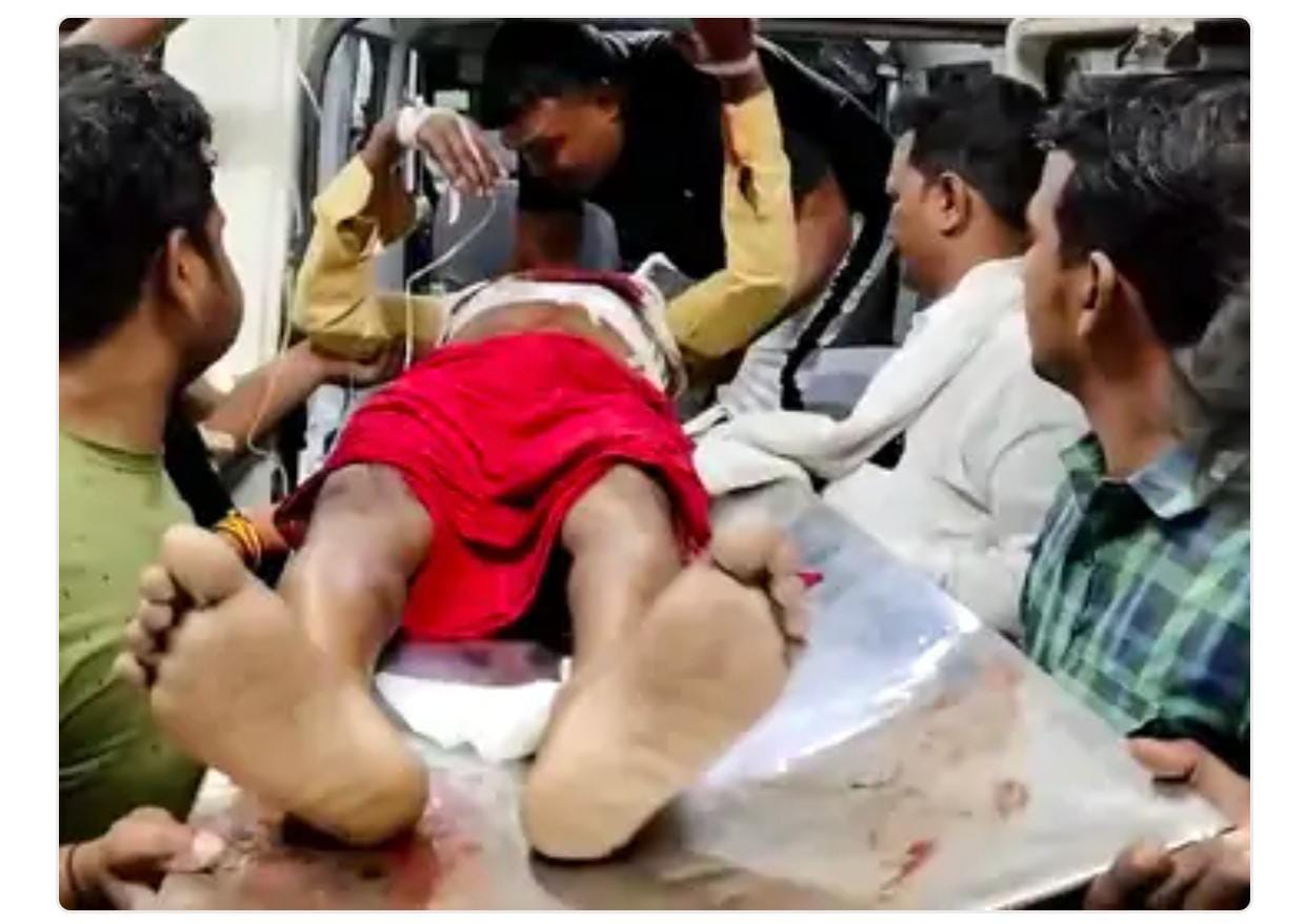 गाजीपुर में युवक को गोली मारी गई, गंभीर हालत में वाराणसी रेफर