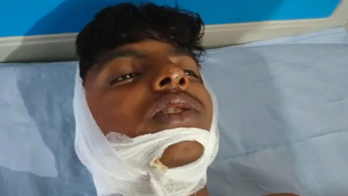 Student neck cut with Chinese manja in Bijnor