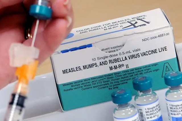 Mumps Cases On the Rise in Delhi-NCR