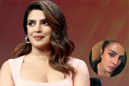 Priyanka Chopra Injured