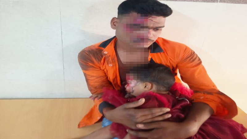 Injured father daughter