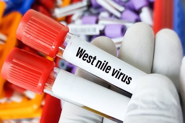 West Nile Fever: Symptoms and Prevention Measures