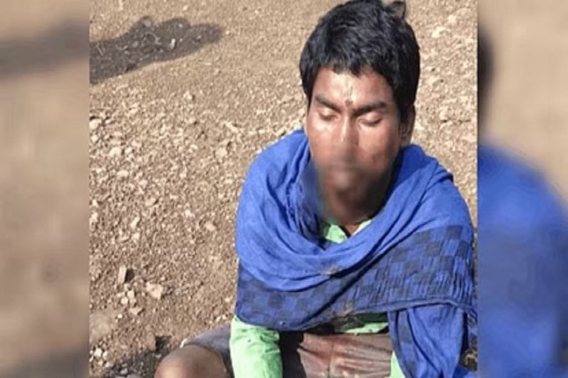 Young man cuts his tongue in Bhilai