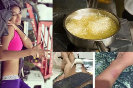 Nia Sharma Injured News