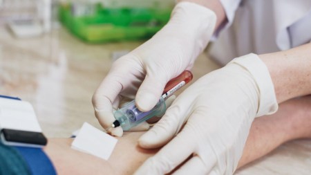 Vitamin D Test