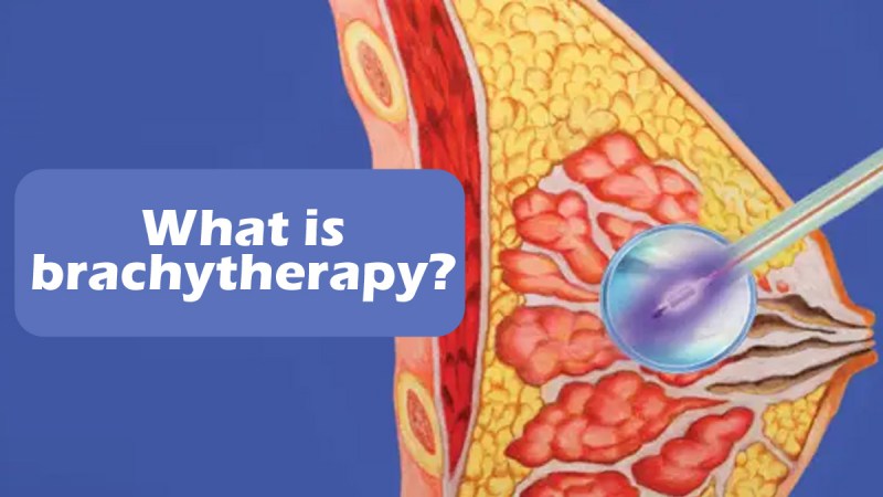 Brachytherapy