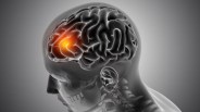 What is brain tumor