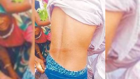 police man allegedly beat the youth and made him unconscious in Banswara, Rajasthan