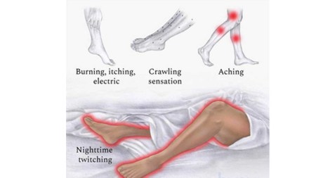 Restless Leg Syndrome treatment, Genetic clues restless leg syndrome, Restless leg syndrome research 2024, University of Munich restless leg, University of Cambridge restless leg, Restless leg syndrome genetic study, Nature Genetics restless leg, New drugs for restless leg syndrome, Anticonvulsants restless leg syndrome, Perampanel restless leg syndrome, Lamotrigine restless leg syndrome, Glutamate receptors restless leg, Restless leg syndrome genetic loci, Restless leg syndrome in women, Restless leg syndrome trials,