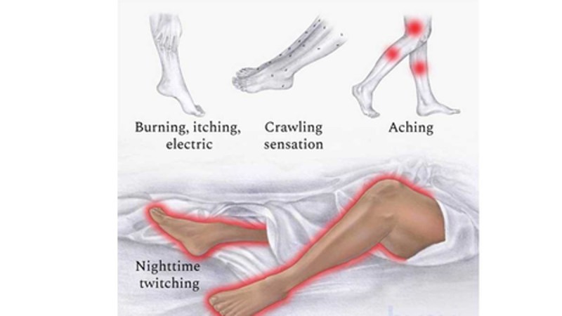 Restless Leg Syndrome treatment, Genetic clues restless leg syndrome, Restless leg syndrome research 2024, University of Munich restless leg, University of Cambridge restless leg, Restless leg syndrome genetic study, Nature Genetics restless leg, New drugs for restless leg syndrome, Anticonvulsants restless leg syndrome, Perampanel restless leg syndrome, Lamotrigine restless leg syndrome, Glutamate receptors restless leg, Restless leg syndrome genetic loci, Restless leg syndrome in women, Restless leg syndrome trials,