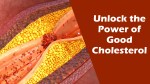 न्यूरोलॉजिस्ट से जानिए Good cholesterol को बढ़ाने के आसान उपाय - image