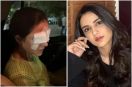 jasmin bhasin cornea damage news in hindi
