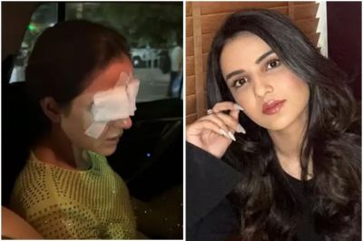 jasmin bhasin cornea damage news in hindi
