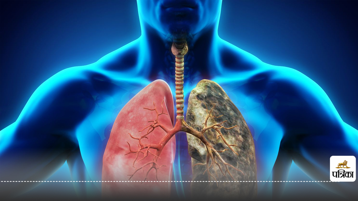 Lung Disease : चीन की चमत्कारी फंगस से फेफड़ों की बीमारी का इलाज संभव