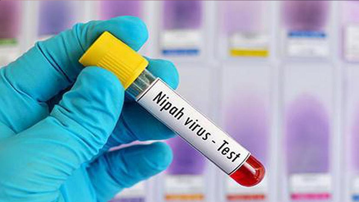 केरल में निपह वायरस के दस्तक से स्वास्थ्य विभाग हुआ सतर्क