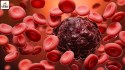 Groundbreaking Trojan Horse Therapy for Blood Cancer Treatment