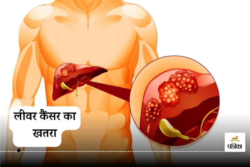 liver cancer prevention