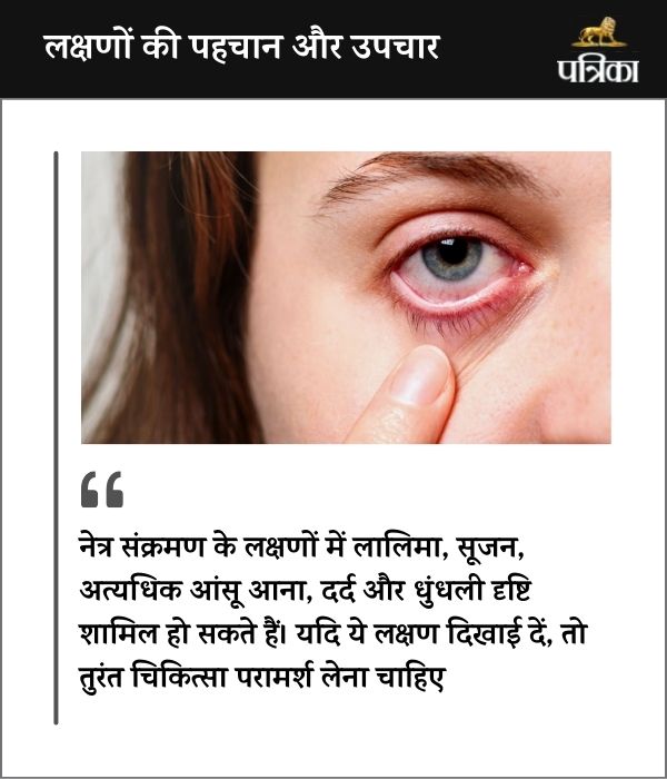 Monsoon eye care