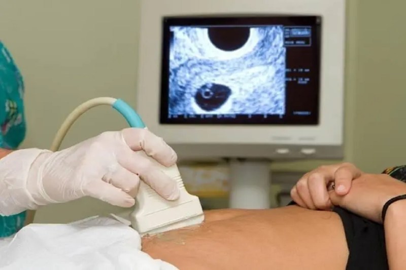 sonography