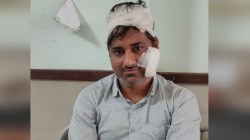 Dungarpur News : शरारत पर डांटा तो विद्यार्थी ने शिक्षक का सिर फोड़ा, अस्पताल
में भर्ती - image