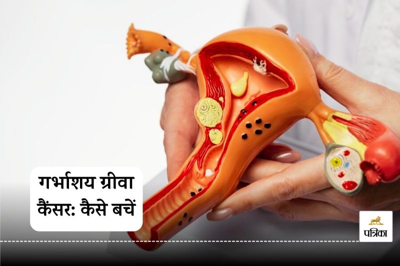 Cervical Cancer Explore the Causes, Symptoms, and Prevention Methods