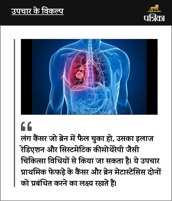 Lung Cancer Most Likely to Spread to Brain