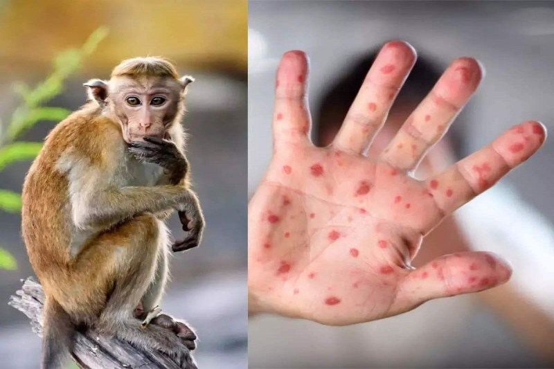 Monkypox virus in cg,