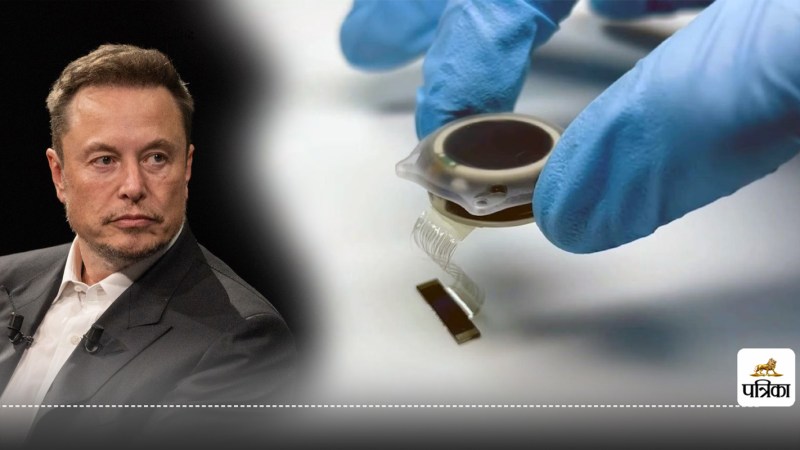 Neuralink Brain Chip: Hundreds Poised for a Life-Altering Chang