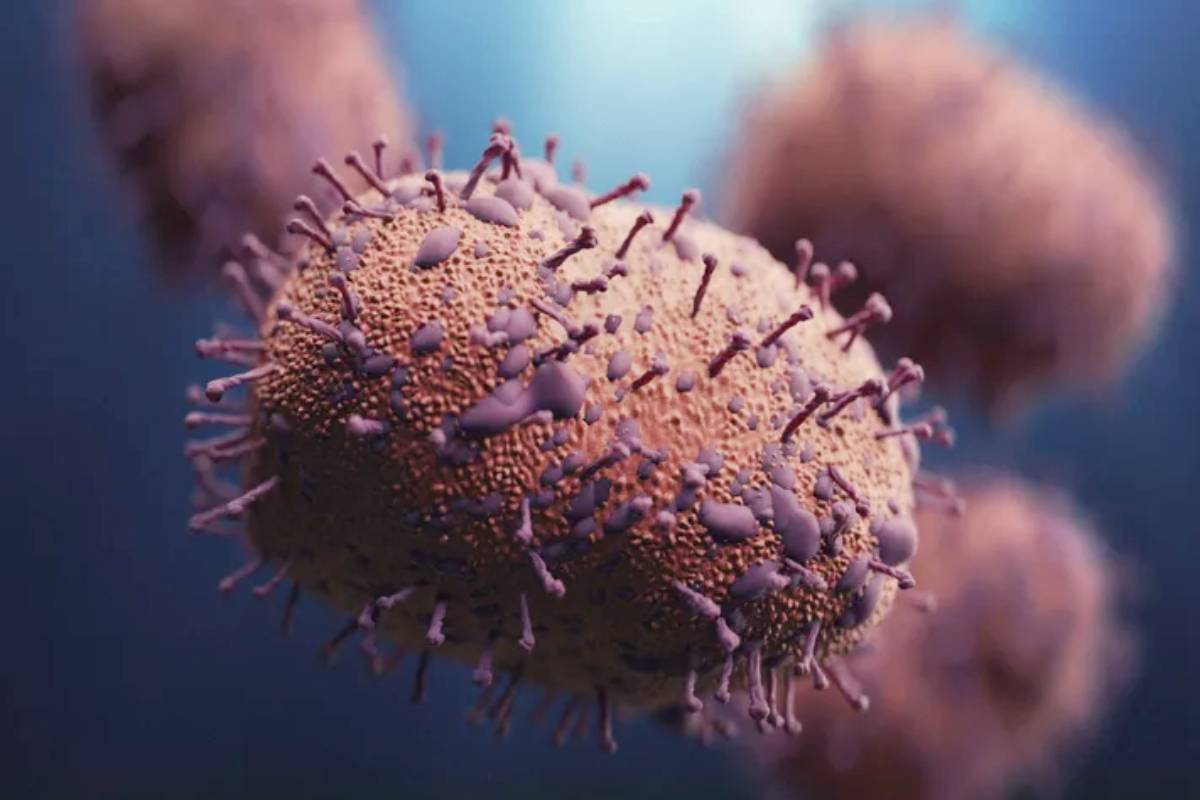 Swine Flu