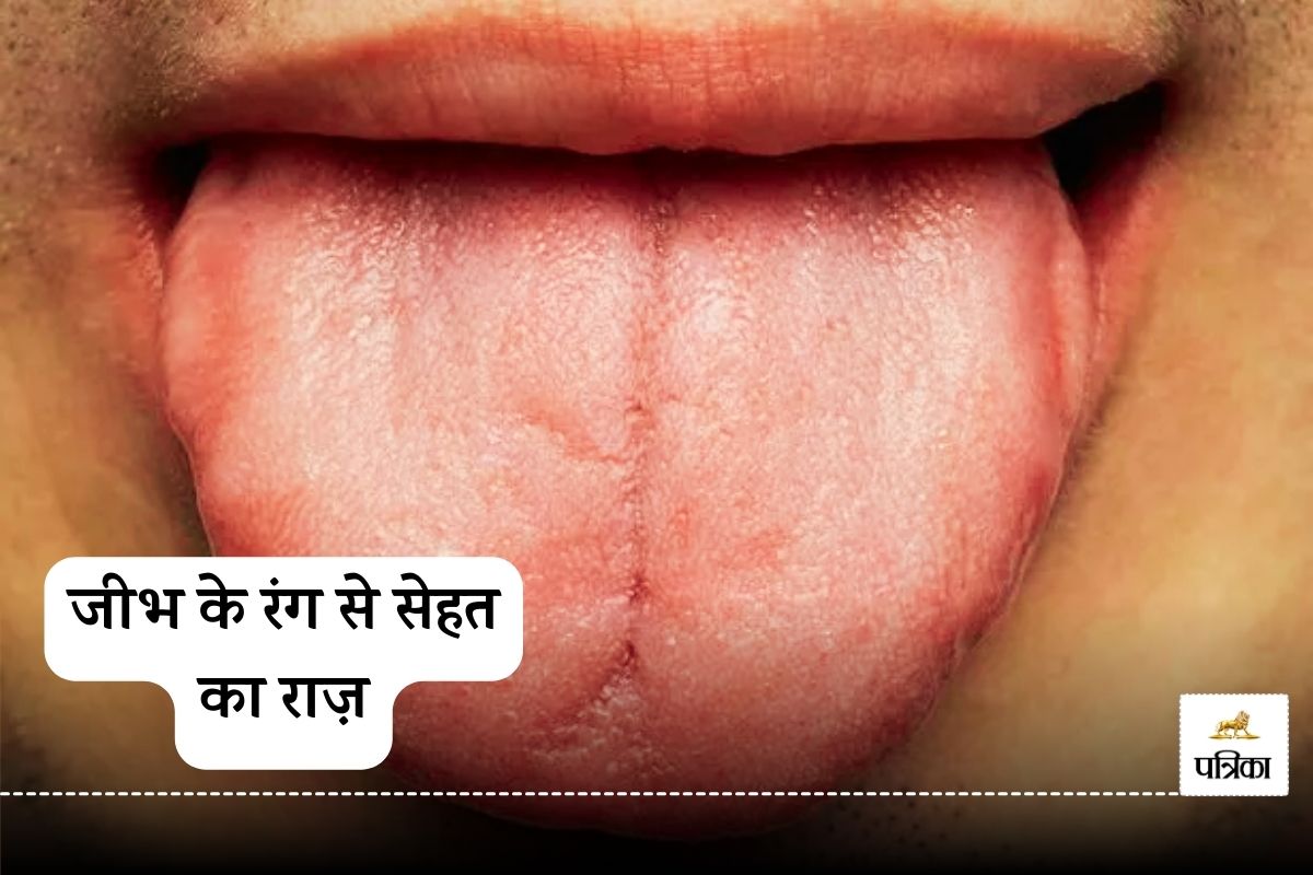Tongue Color Reveals Diabetes and Stroke with 98% Accuracy