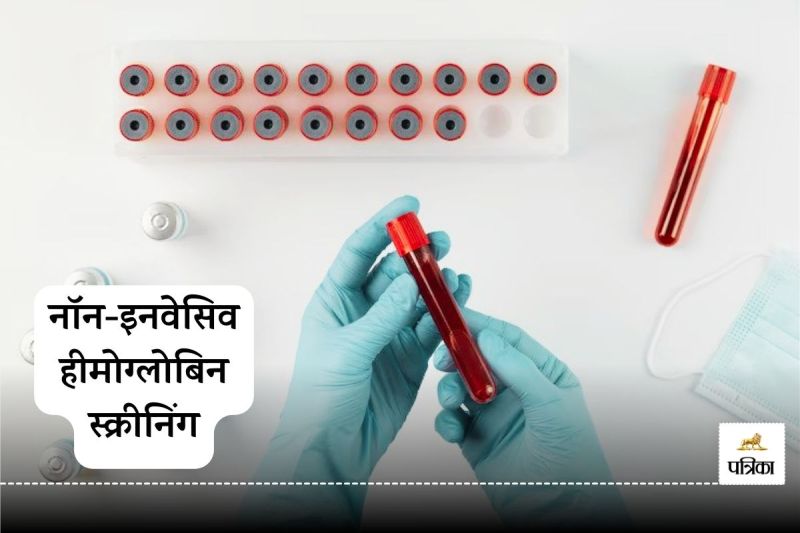 Hemoglobin test without blood sample
