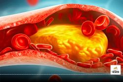 सिर्फ ये 3 आसान उपाय, Bad Cholesterol से पाएं छुटकारा - image