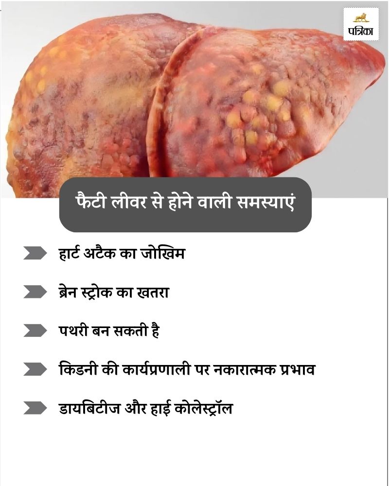 Fatty liver side effects 