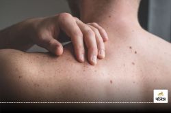 Skin cancer : शरीर पर दिखने लगे ऐसे निशान तो हो जाए सावधान, स्किन कैंसर का हो
सकता है खतरा - image