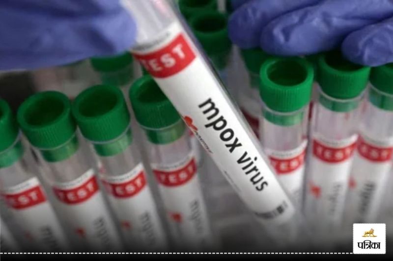 India reports suspected Mpox case patient's condition stable