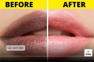 Lip care tips : Your lips deserve the best