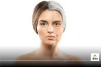 Longevity tips Aging Accelerates at 44 and 60: Are You Ready