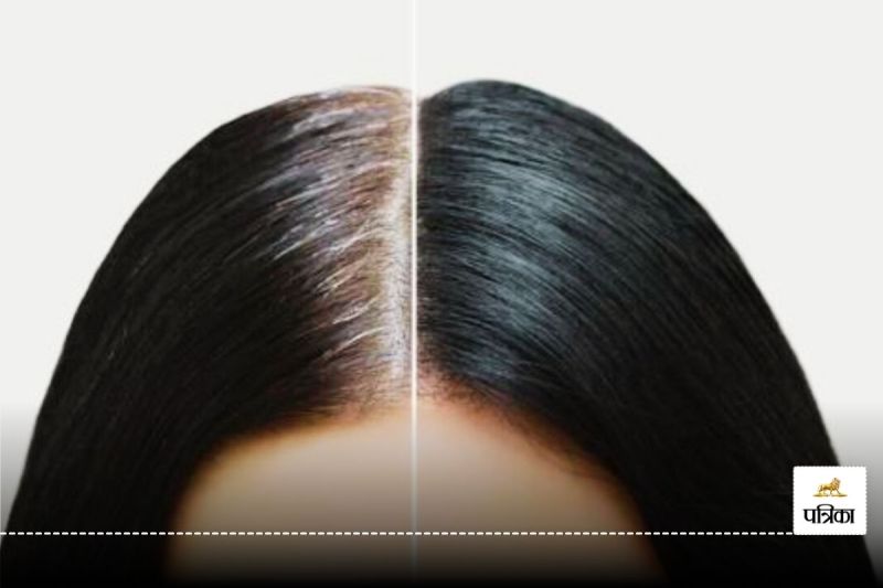 Prevent black hair from turning white today
