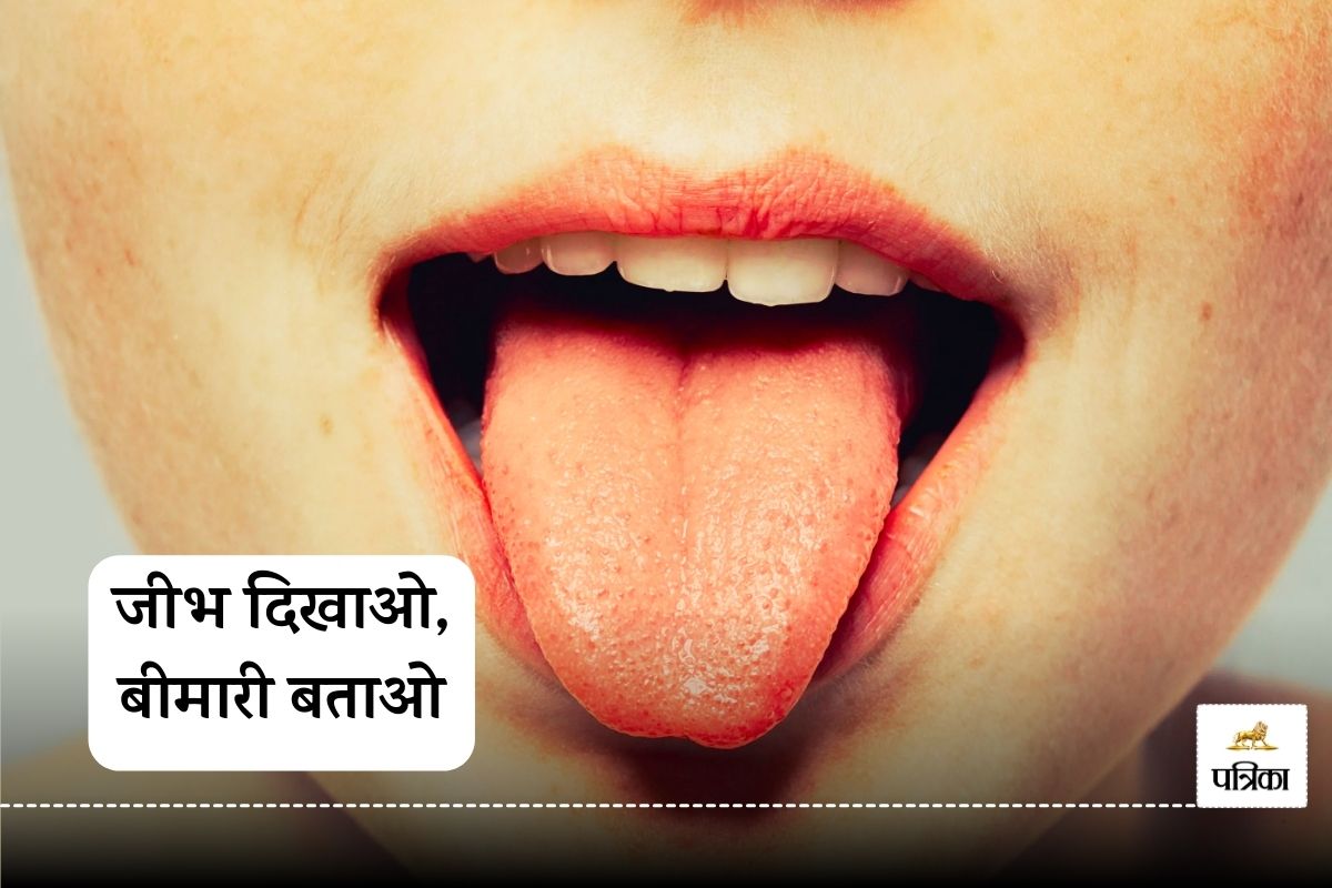 Disease detection from tongue images