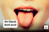 Disease detection from tongue images