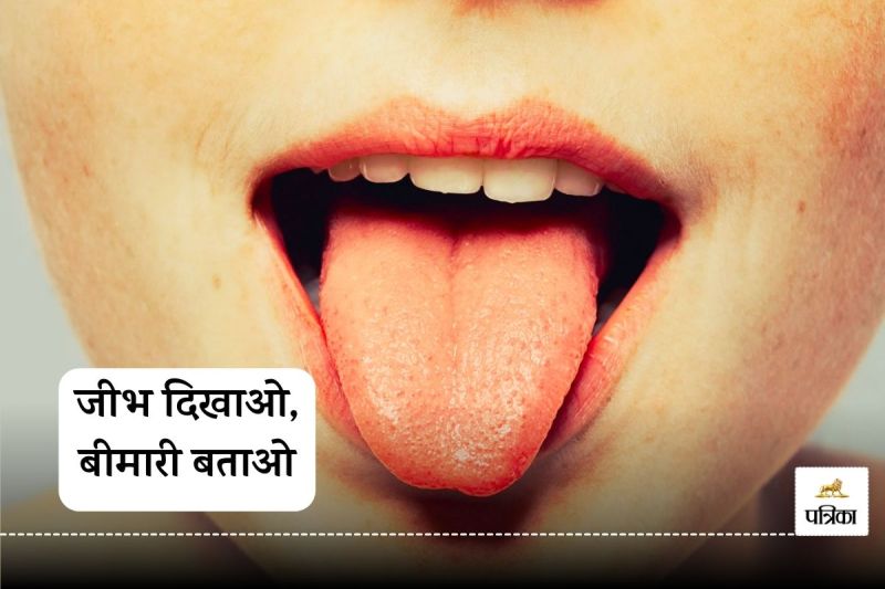 Disease detection from tongue images