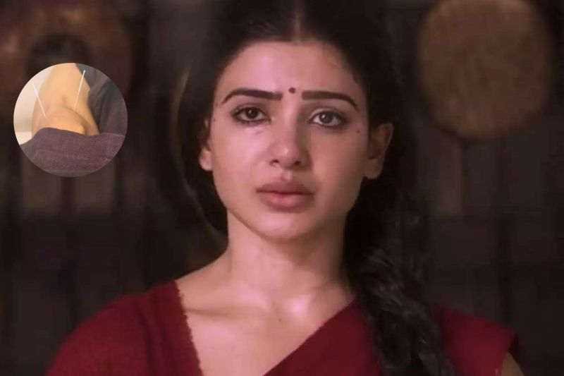 Samantha Ruth Prabhu needle treatment picture viral is she injured herself