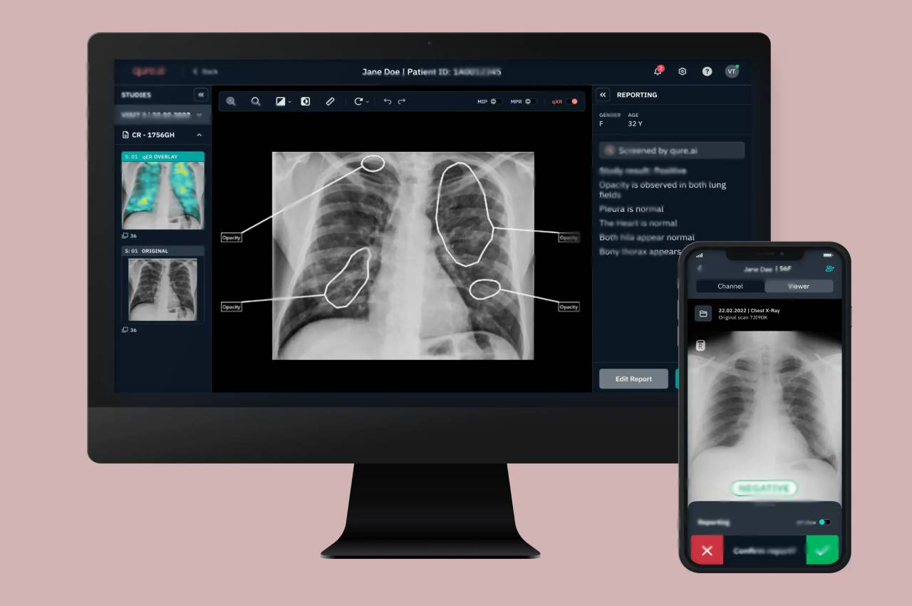 x-ray report on mobile