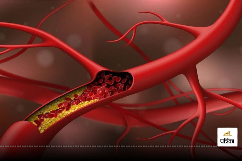 Cholesterol : If these symptoms are seen on the body then do not ignore them, these symptoms indicate these diseases