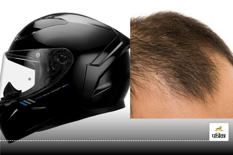 Hair loss : Is helmet the reason behind hair fall, know the truth